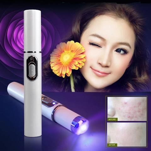 Blue Light Therapy Acne Laser Pen - PixelGlamour